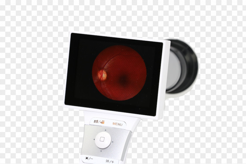 Optometry Fundus Photography Retina Eye PNG