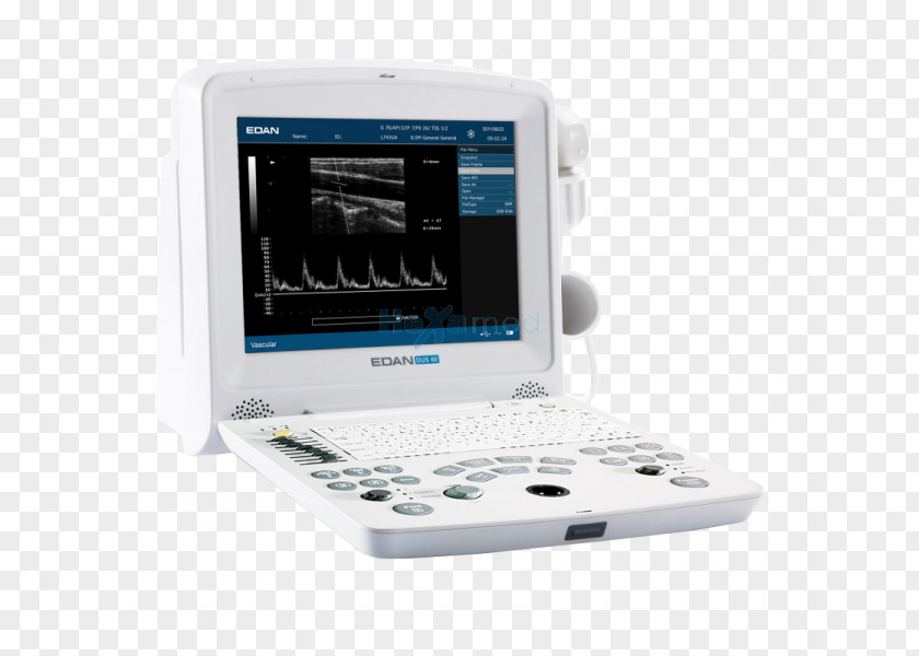 Doppler Imaging Ultrasound Ultrasonography Ecógrafo Medical Equipment PNG