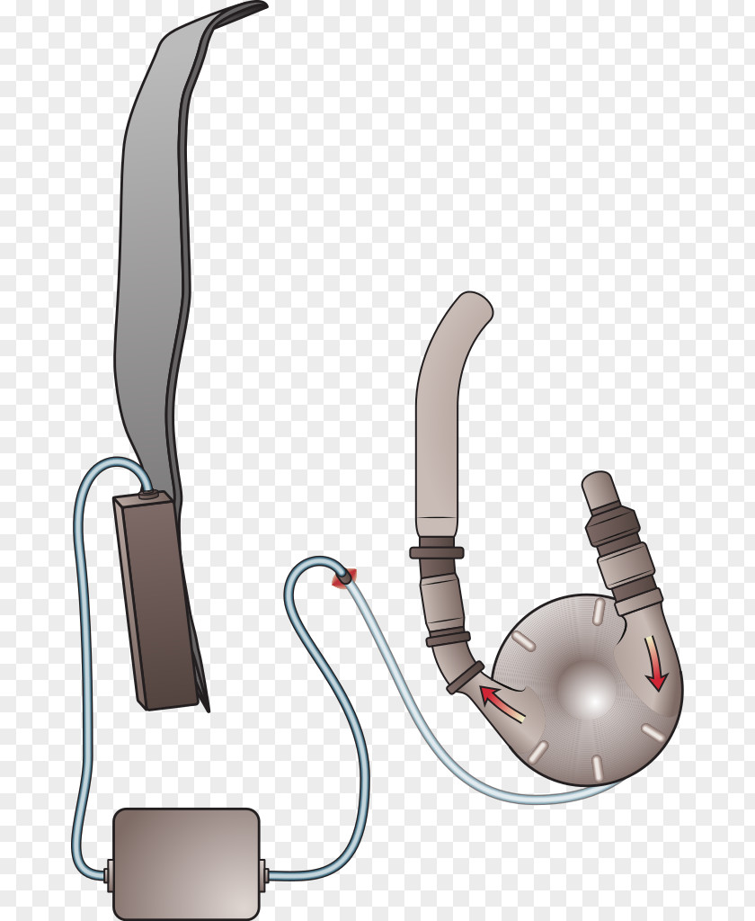Heart Ventricular Assist Device Ventricle Artificial Implant PNG
