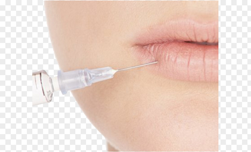 Woman Playing Hyaluronic Acid Skin Reconstructive Surgery Injection PNG