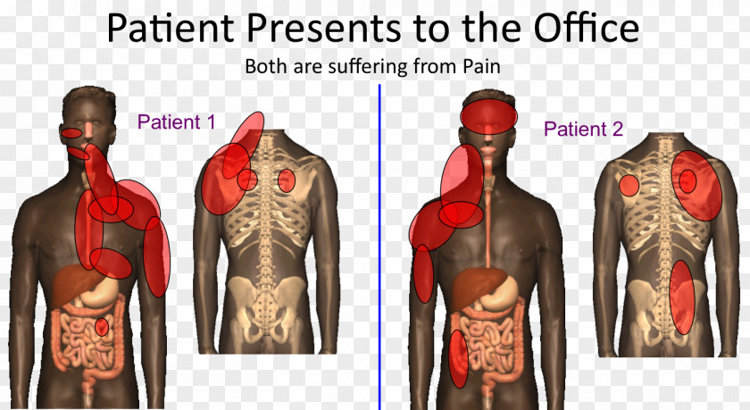 Somatic Referred Pain Shoulder Problem Liver Muscle PNG