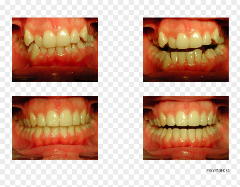 Orange Tooth Polska Close-up Therapy PNG