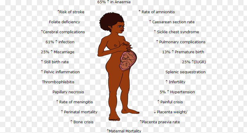 Red Variant Cancer Cell Sickle Disease Pregnancy Anemia PNG