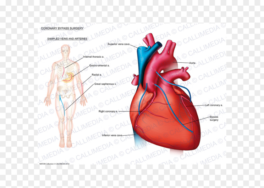 Heart Disease: A Textbook Of Cardiovascular Medicine Anatomy Coronary Artery Disease Cardiology PNG