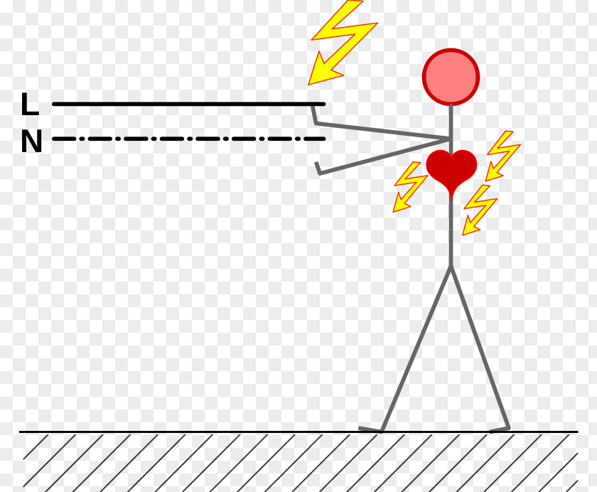 Electric Shock Electrical Injury Current Diagram Clip Art PNG