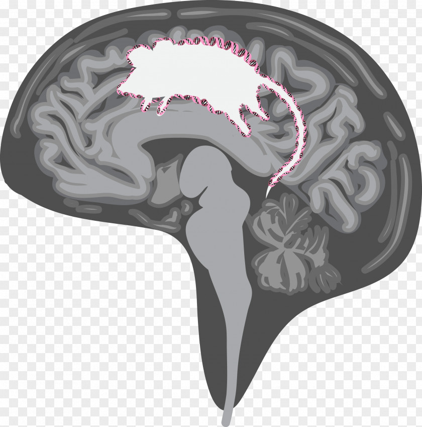 Jellyfish Medusa Tentacle Symbol Brain PNG