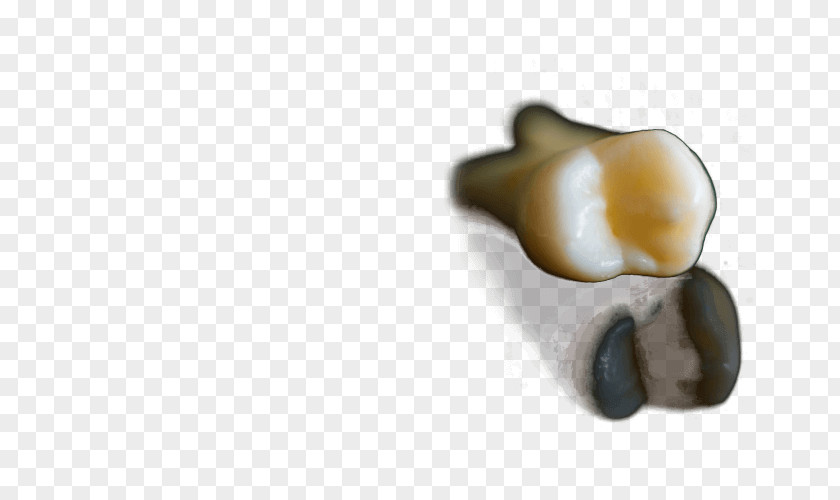 Tooth Pain Body Jewellery PNG