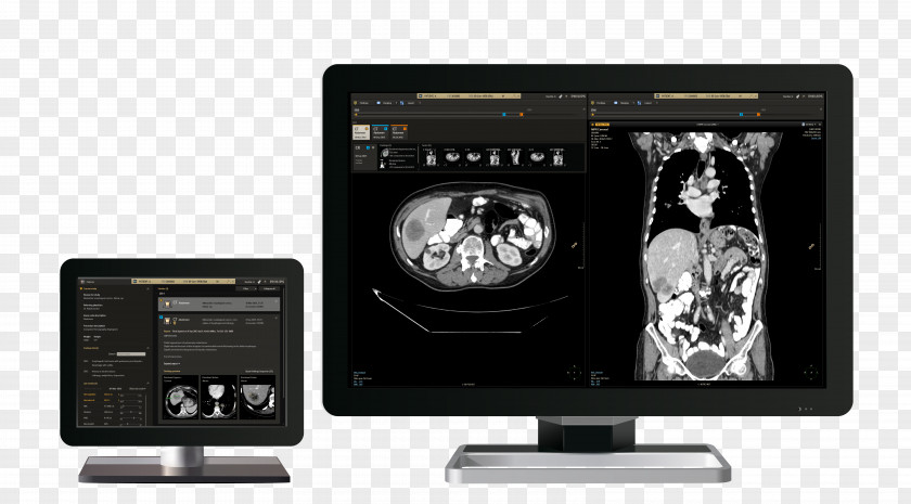 Picture Archiving And Communication System Philips Radiology Template Electronics PNG