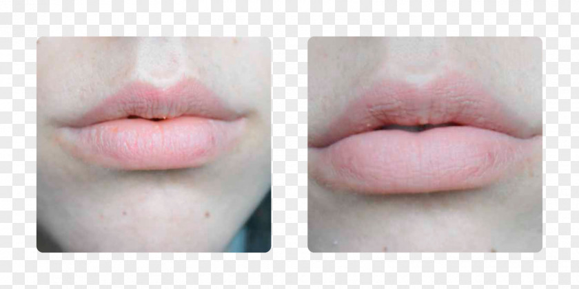 Sos Hydration Inc Lip Gloss Close-up PNG