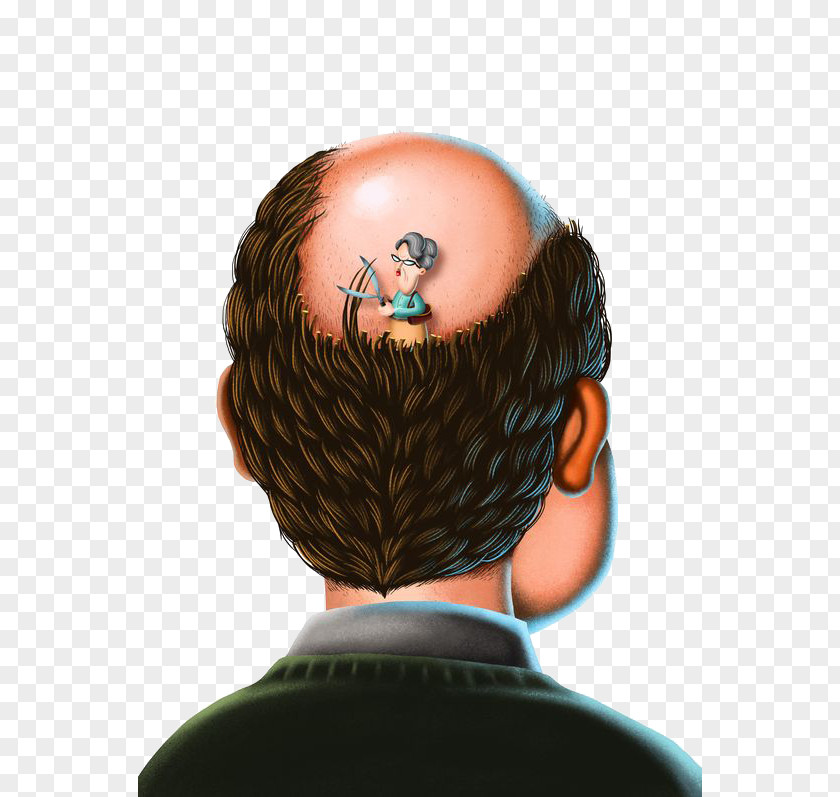 Bald Man Hair Loss Botak PNG