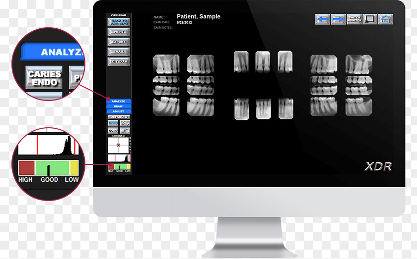 Orthodontic Correction Touchscreen Computer Software Display Device Sensor PNG