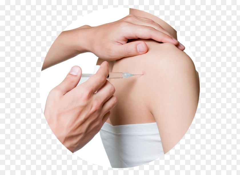 Orthopedics Myofascial Trigger Point Joint Injection Therapy Medicine PNG