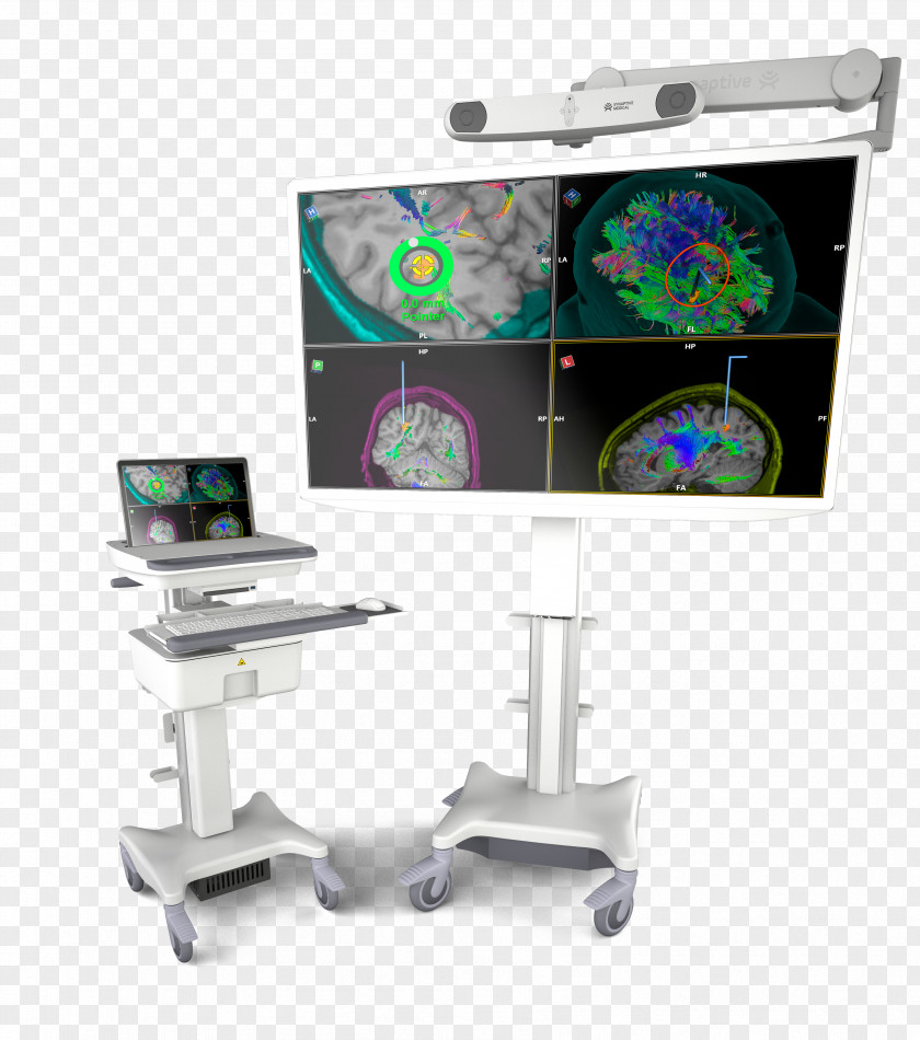 Operation Theatre Synaptive Medical Table Neuronavigation Computer-assisted Surgery Information PNG