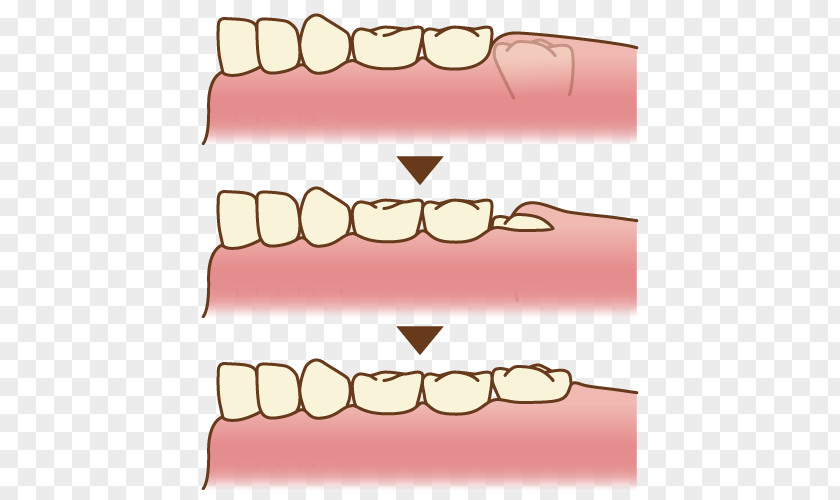 Molar Tooth Dentistry Clip Art PNG
