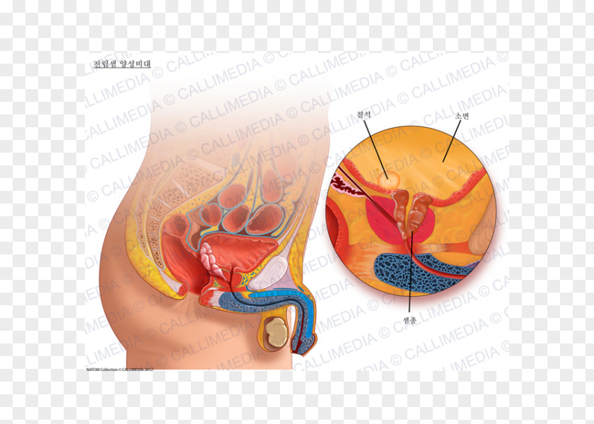 Prostate Gland Genitourinary System Benign Prostatic Hyperplasia Urinary Bladder Urology PNG