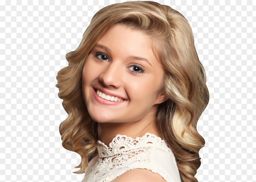 Hair Clear Aligners Coloring Dental Braces Blond Malocclusion PNG