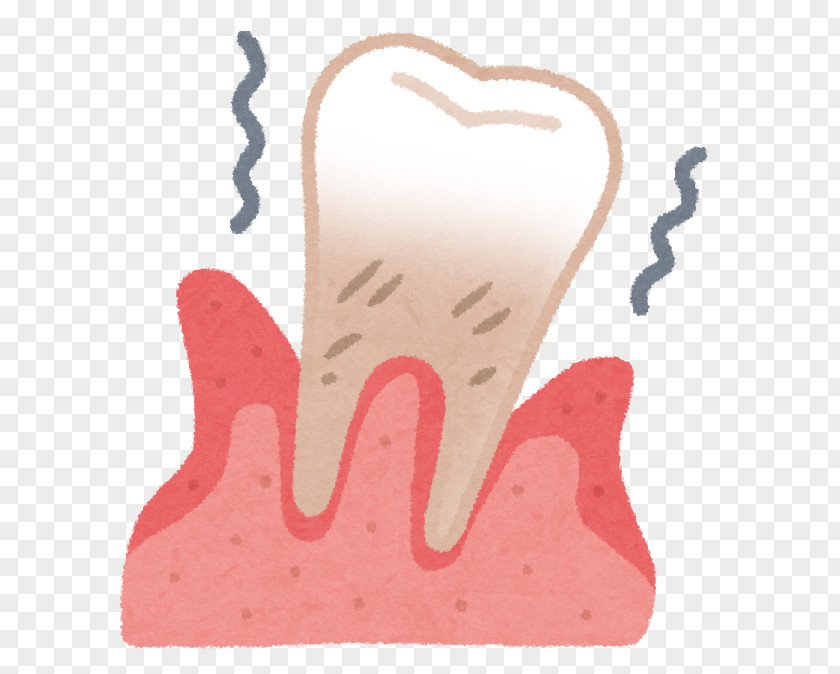 Periodontal Disease Gums Dentist 歯科 PNG