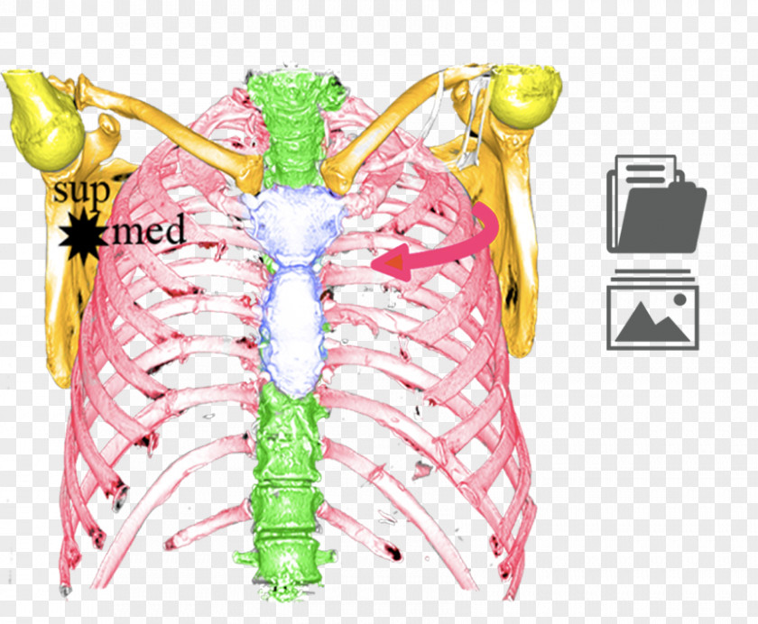 Sternoclavicular Joint Arthrology Shoulder Girdle Clavicle Anatomy PNG