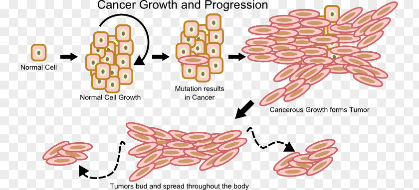 Cancer Cell Growth Neoplasm PNG