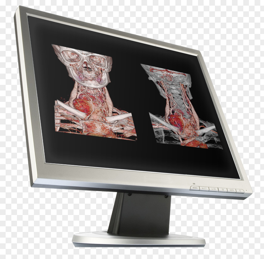 Semar Computer Monitors Workflow Image Computed Tomography Canon Medical Systems Corporation PNG