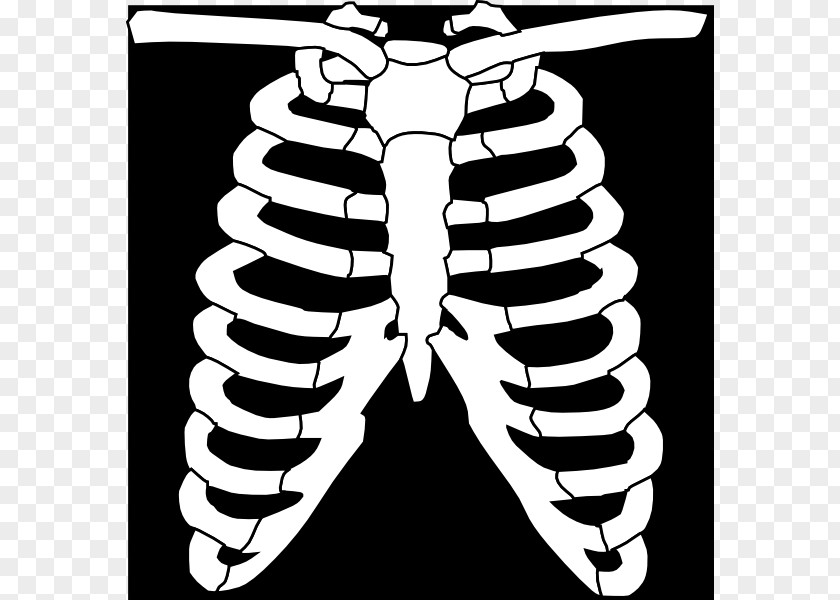 Ray Cliparts X-ray Generator White Clip Art PNG