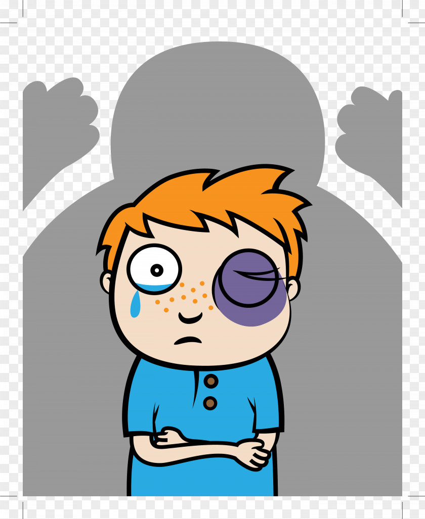 Bruise Black Eye Royalty-free Clip Art PNG