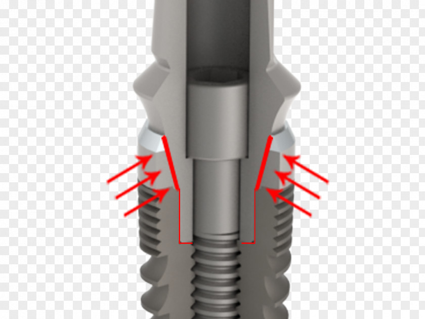 Octagon Dental Implant Abutment Dentistry Tooth PNG