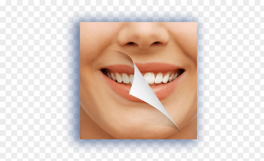 Tooth Whitening Cosmetic Dentistry Oral Hygiene PNG whitening dentistry hygiene, clipart PNG