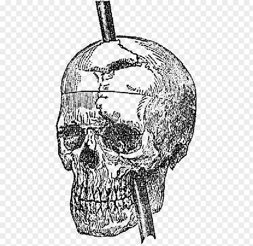 Iron Bar Skull Psychology United States Brain PNG