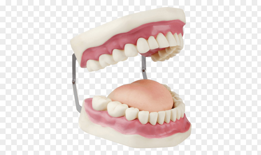 Dentures Dentistry Dental Instruments Human Tooth Implant PNG