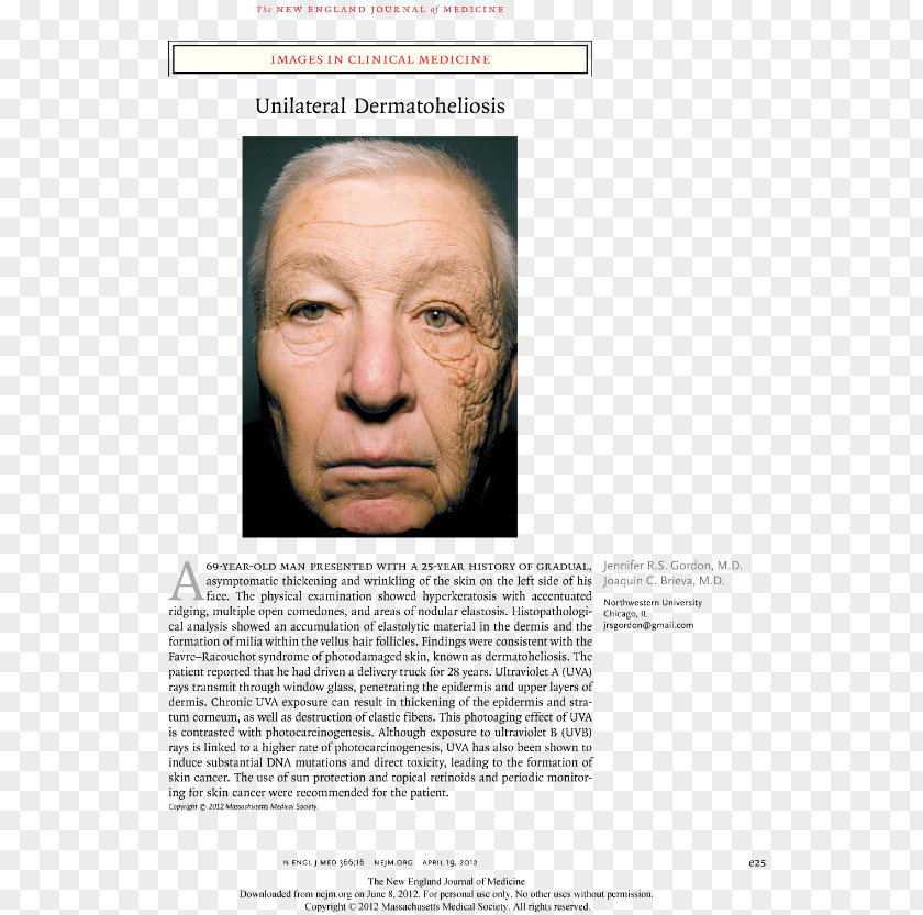 Face Photoaging Ultraviolet Skin Care Truck Driver PNG