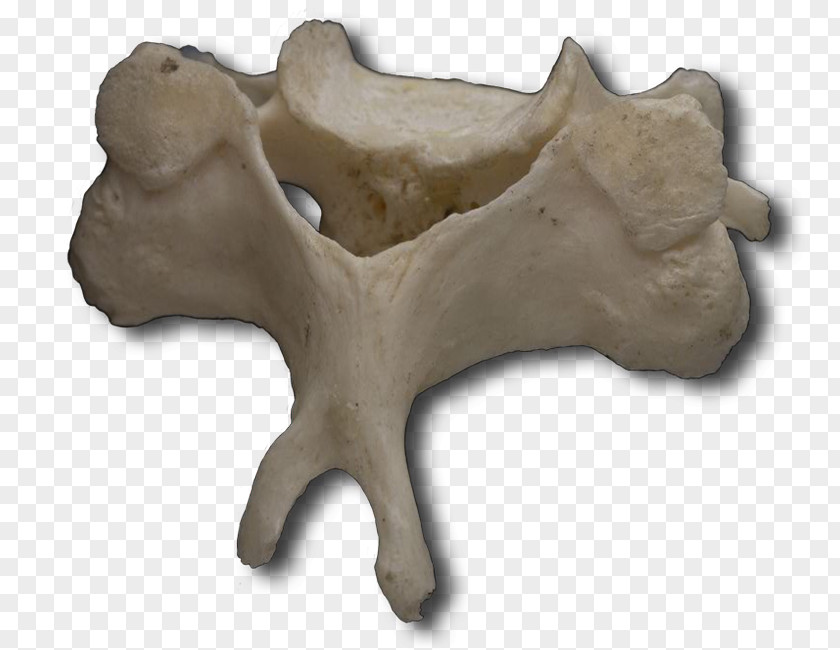Vertebral Human Column Cervical Vertebrae Atlas PNG
