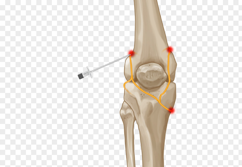 Cambridge Consultants Knee Pain Thumb Joint Hip PNG