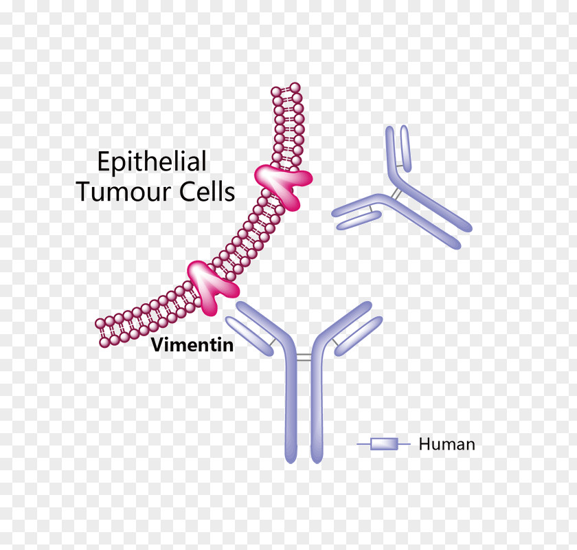 Glioma Trastuzumab Emtansine Erenumab Pharmaceutical Drug Vemurafenib PNG