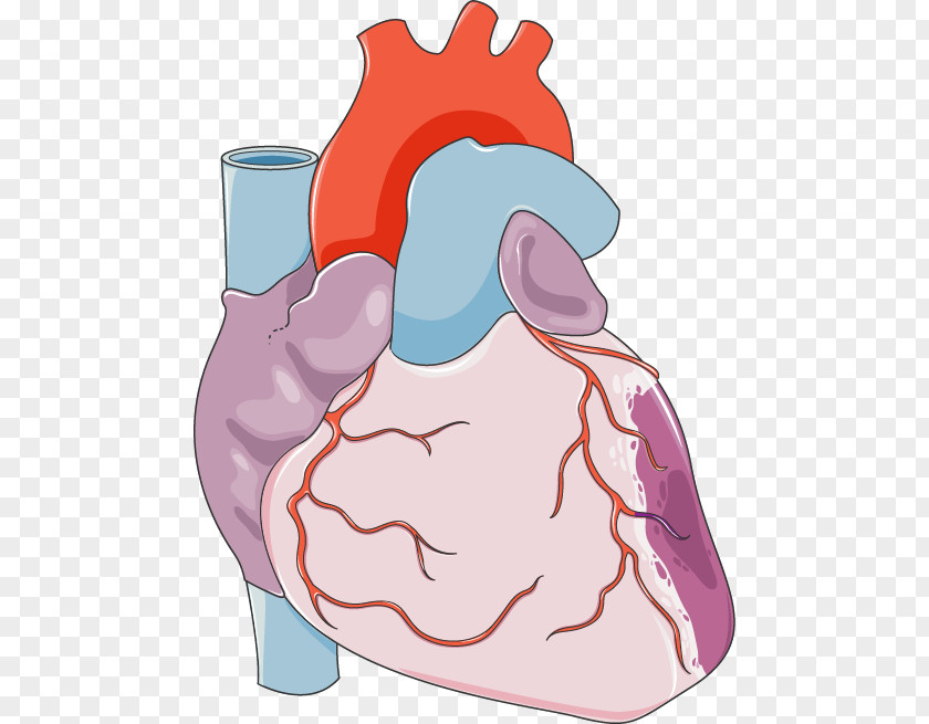 Heart Coronary Artery Bypass Surgery Disease Cardiovascular PNG