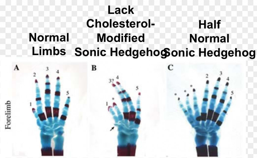 Mouse Sonic Hedgehog GLI3 Signaling Pathway Polydactyly PNG