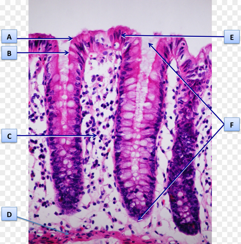 LETRA F Mucous Membrane Intestinal Gland Goblet Cell Histology Colon PNG