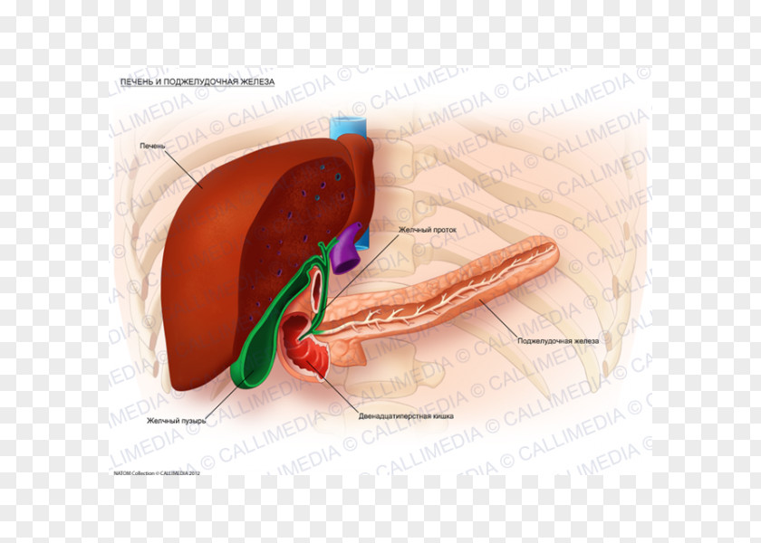 Liver Human Metastasis Bile Duct Gallbladder Hepatocellular Carcinoma PNG
