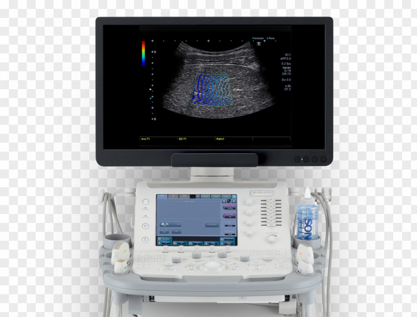 Radiation Efficiency Ultrasonography Medical Equipment Diagnosis Hospital Technology PNG