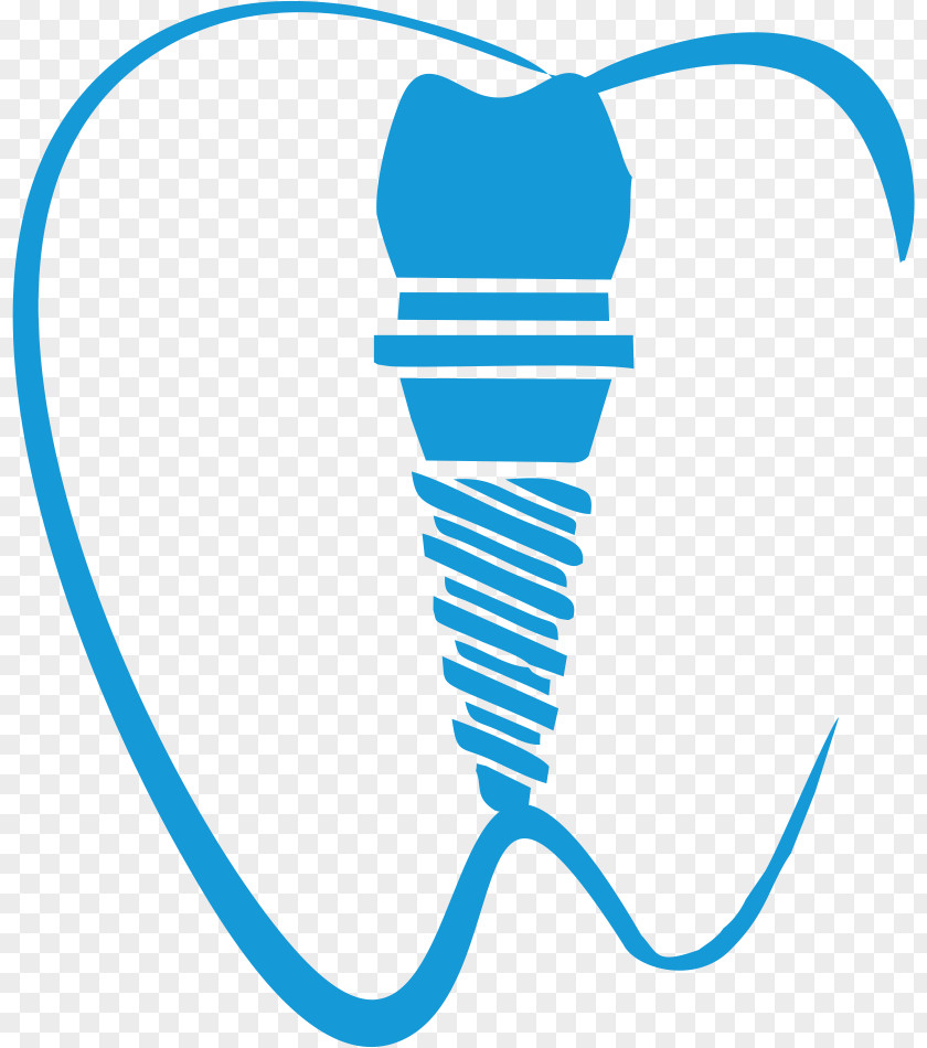 Dente Dental Implant Dentistry Tooth Clip Art PNG