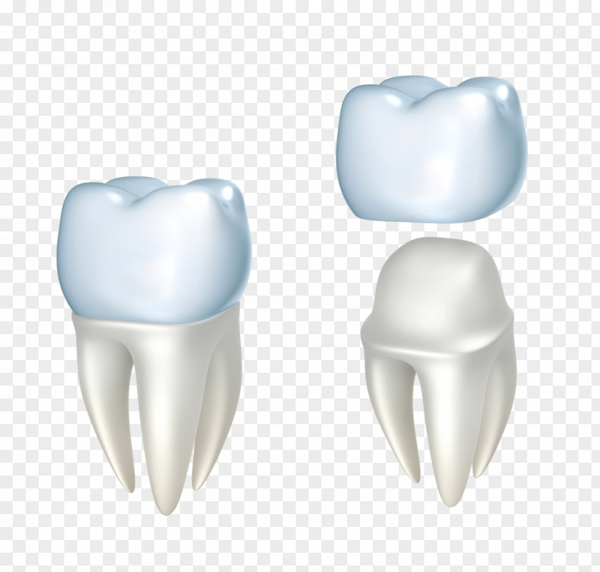 Dental Floss Crown Dentistry Restoration Bridge PNG