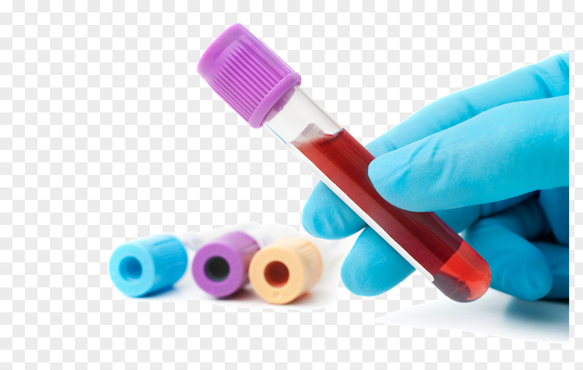 Blood Test Liver Function Tests Medical Diagnosis Drawing PNG