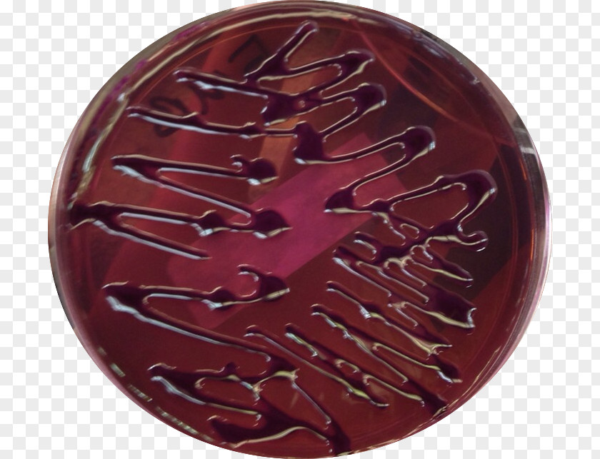 Staphylococcus Aureus Klebsiella Pneumoniae Eosin Methylene Blue Agar Plate Sang PNG