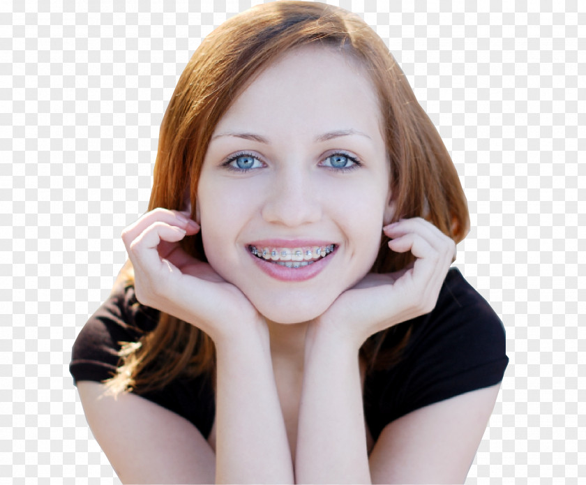 Dentistry Dental Braces Orthodontics Clear Aligners Damon System PNG
