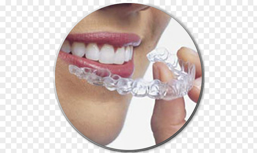Health Clear Aligners Dental Braces Orthodontics Dentistry Therapy PNG