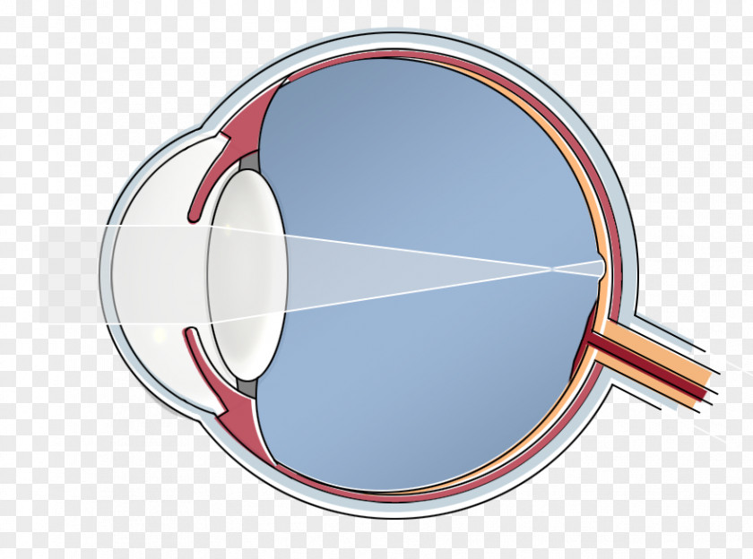 Dragen Epi-LASIK Human Eye Hypermetropia Blind Spot PNG