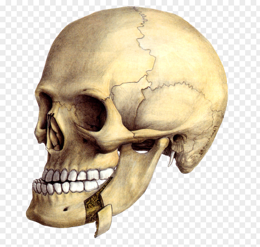 Mandible Osteotomy Chin Surgery Jaw PNG