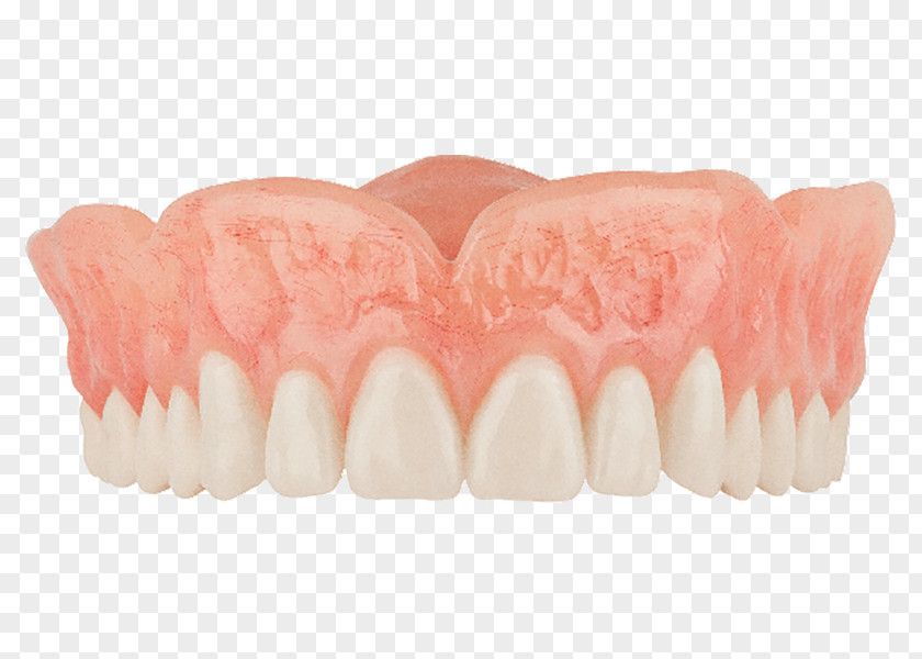 High Grade Shading Tooth Dentures Dentistry Removable Partial Denture PNG