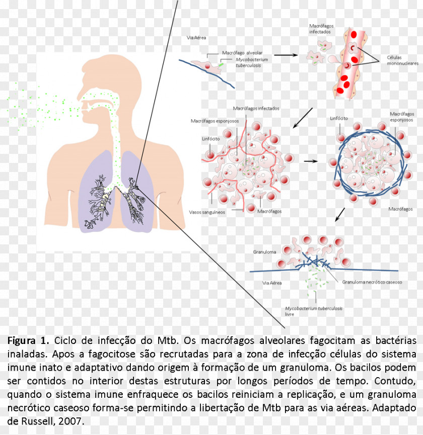 Imune Mycobacterium Tuberculosis Pathogenesis Disease Infection PNG