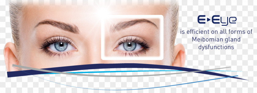 Face Blepharoplasty Eyelid Surgery Dry Eye Syndrome PNG